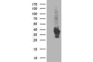 HEK293T cells were transfected with the pCMV6-ENTRY control (Left lane) or pCMV6-ENTRY HSPBP1 (Right lane) cDNA for 48 hrs and lysed. (HSPBP1 antibody)