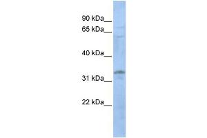 WB Suggested Anti-LYL1  Antibody Titration: 0. (LYL1 antibody  (N-Term))