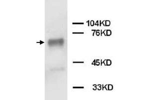 Western Blot analysis of PTPN11 expression from Jurkat cell lyate with PTPN11 polyclonal antibody . (PTPN11 antibody  (C-Term))