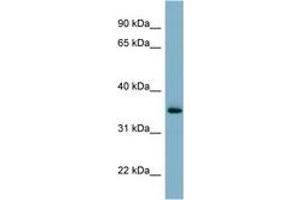 Image no. 1 for anti-GTP Binding Protein Overexpressed in Skeletal Muscle (GEM) (AA 35-84) antibody (ABIN6741918) (GEM antibody  (AA 35-84))