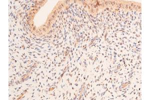 ABIN6267066 at 1/200 staining rat uterine tissue sections by IHC-P. (p53 antibody  (acLys319))