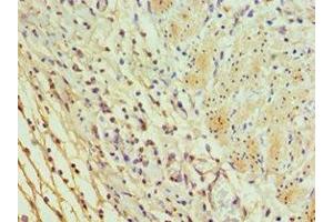 Immunohistochemistry of paraffin-embedded human epityphlon tissue using ABIN7156037 at dilution of 1:100 (ICOSLG antibody  (AA 19-256))