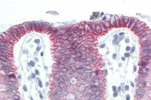 Human Colon (formalin-fixed, paraffin-embedded) stained with CTNNB1 antibody ABIN364501 at 10 ug/ml followed by biotinylated anti-mouse IgG secondary antibody ABIN481714, alkaline phosphatase-streptavidin and chromogen. (CTNNB1 antibody  (C-Term))