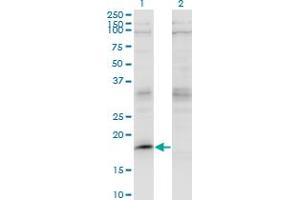 Western Blot analysis of LMO2 expression in transfected 293T cell line by LMO2 monoclonal antibody (M07), clone 4E2. (LMO2 antibody  (AA 16-102))
