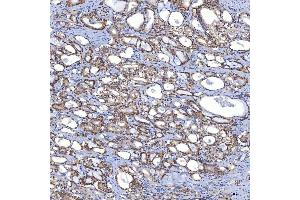 IHC analysis of TRMT61A using anti-TRMT61A antibody (ABIN7599220). (TRMT61A antibody  (AA 1-289))