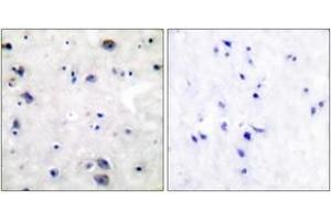 Immunohistochemistry (IHC) image for anti-Opioid Receptor, mu 1 (OPRM1) (AA 341-390) antibody (ABIN2888574) (Mu Opioid Receptor 1 antibody  (AA 341-390))