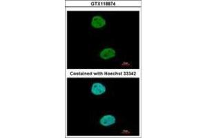 Image no. 3 for anti-General Transcription Factor IIIC, Polypeptide 4 (GTF3C4) (AA 73-334) antibody (ABIN1498564) (GTF3C4 antibody  (AA 73-334))