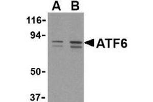Western blot analysis of ATF6 in MCF7 cell lysate with this product atF6 antibody at (A) 0. (ATF6 antibody  (C-Term))