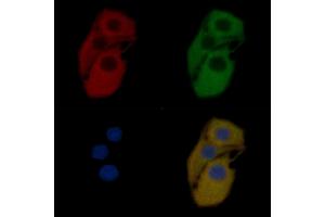 MAGB6 Mouse Monoclonal Antibody staining Hela cells by IF/ICC.