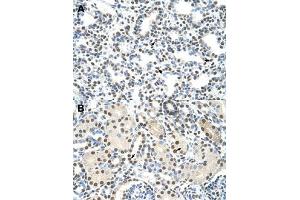 Immunohistochemical staining (Formalin-fixed paraffin-embedded sections) of human lung (A) and human kidney (B) with AKAP8L polyclonal antibody  at 4-8 ug/mL working concentration. (AKAP8L antibody  (C-Term))