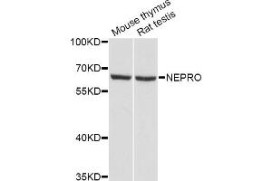 Western blot analysis of extracts of various cell lines, using NEPRO Antibody (ABIN5998324) at 1/1000 dilution.