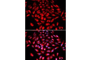 Immunofluorescence analysis of U2OS cells using CAMK4 antibody (ABIN5973050).