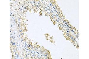 Immunohistochemistry of paraffin-embedded Human prostate using PPP3R1 Polyclonal Antibody at dilution of 1:100 (40x lens).