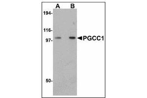 Western blot analysis of PGCC1 in rat thymus tissue lysate with PGCC1 antibody at (A) 0.