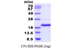 SDS-PAGE (SDS) image for NME/NM23 Nucleoside Diphosphate Kinase 4 (NME4) (AA 33-187) (Active) protein (His tag) (ABIN6387712)