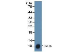 Detection of TFF3 in Rat Uterus Tissue using Polyclonal Antibody to Trefoil Factor 3 (TFF3) (TFF3 antibody  (AA 23-81))