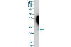 IFNA16 MaxPab rabbit polyclonal antibody. (IFNA16 antibody  (AA 1-189))