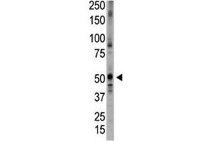 Western blot testing of BMPR antibody and placenta tissue lysate. (BMP5 antibody  (AA 16-46))