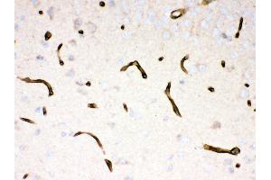 Immunohistochemistry (IHC) image for anti-Dystrophin (DMD) (AA 3076-3404) antibody (ABIN3043317)
