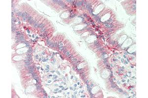 Human Small Intestine: Formalin-Fixed, Paraffin-Embedded (FFPE) (Galectin 3 antibody  (AA 1-58))