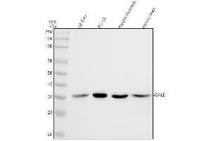 anti-UDP-Galactose-4-Epimerase (GALE) (AA 1-340) antibody