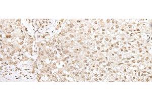 ZKSCAN3 antibody