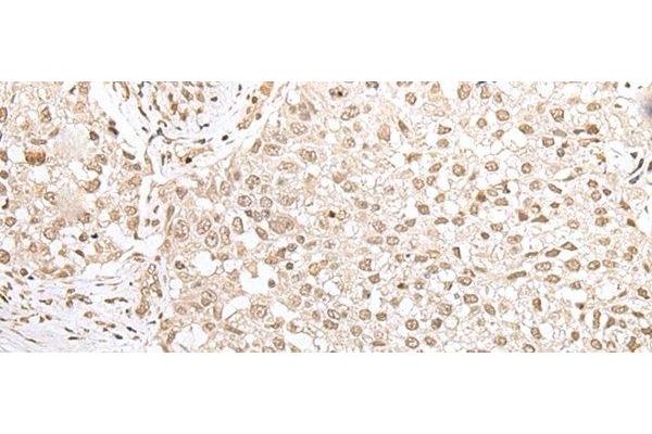 ZKSCAN3 antibody