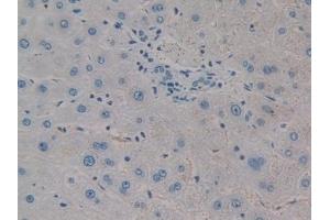 #VALUE! (CTHRC1 antibody  (AA 31-243))