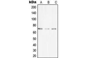 Western blot analysis of CLIP4 expression in THP1 (A), SP2/0 (B), H9C2 (C) whole cell lysates. (CLIP4 antibody  (Center))