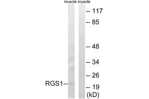 Western blot analysis of extracts from mouse muscle cells, using RGS1 antibody. (RGS1 antibody  (Internal Region))