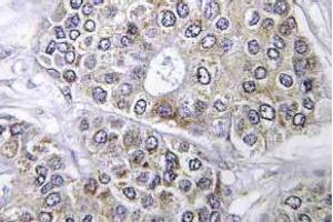 Immunohistochemistry (IHC) analyzes of Bcl-2 antibody in paraffin-embedded human brain tissue. (Bcl-2 antibody)