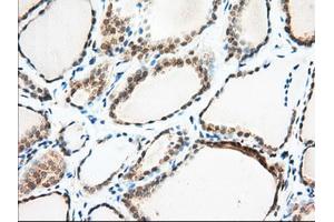 Immunohistochemical staining of paraffin-embedded Human Kidney tissue using anti-MIOX mouse monoclonal antibody. (MIOX antibody)