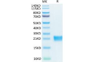 Biotinylated Mouse IL-17A on Tris-Bis PAGE under reduced condition. (Interleukin 17a Protein (AA 26-158) (His-Avi Tag,Biotin))