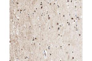 ABIN6267012 at 1/100 staining human brain tissue sections by IHC-P. (CTBP1 antibody  (Internal Region))