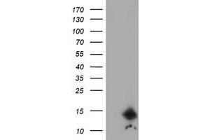 Image no. 1 for anti-Cystatin C (CST3) antibody (ABIN1497753) (CST3 antibody)