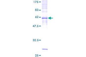 Image no. 1 for Prostaglandin D2 Receptor (PTGDR) (AA 1-359) protein (GST tag) (ABIN1316721)