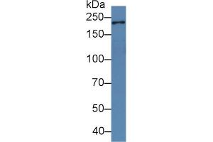 Rabbit Capture antibody from the kit in WB with Positive Control: Human skin lysate. (PPL ELISA Kit)