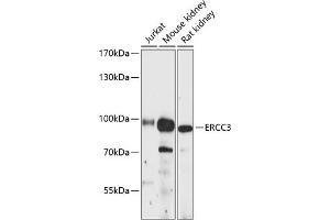Western blot analysis of extracts of various cell lines, using ERCC3 antibody (ABIN6127770, ABIN6140267, ABIN6140268 and ABIN6216436) at 1:3000 dilution.