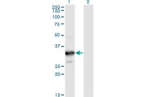 Western Blot analysis of MYOZ2 expression in transfected 293T cell line by MYOZ2 monoclonal antibody (M02), clone 1D4. (MYOZ2 antibody  (AA 1-264))
