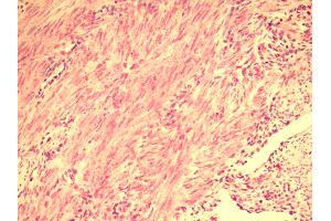 Human Uterus: Formalin-Fixed, Paraffin-Embedded (FFPE) (RXFP2 antibody  (Cytoplasmic Domain))
