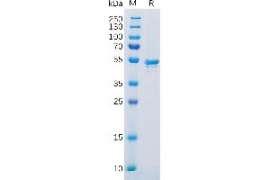 Human CA9 Protein, His Tag on SDS-PAGE under reducing condition. (CA9 Protein (AA 38-414) (His tag))