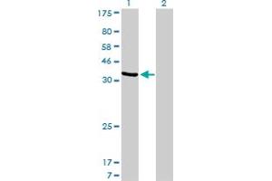 Western Blot analysis of AKR1D1 expression in transfected 293T cell line by AKR1D1 monoclonal antibody (M03), clone 1C2. (AKR1D1 antibody  (AA 227-326))
