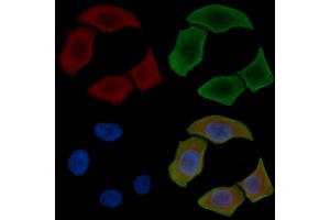 ABIN6263599 and ABIN6277934 staining Hela cells(30 min of UV treatment) by IF/ICC.