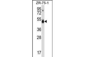 CUGBP1 Antibody (N-term) (ABIN657957 and ABIN2846902) western blot analysis in ZR-75-1 cell line lysates (35 μg/lane). (CELF1 antibody  (N-Term))