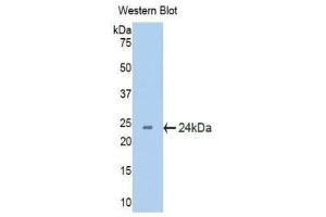 Western Blotting (WB) image for anti-Crystallin, beta B2 (CRYbB2) (AA 17-191) antibody (ABIN1077954) (CRYbB2 antibody  (AA 17-191))