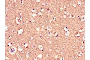 Immunohistochemistry of paraffin-embedded human brain tissue using ABIN7159104 at dilution of 1:100 (MED12 antibody  (AA 1742-2011))