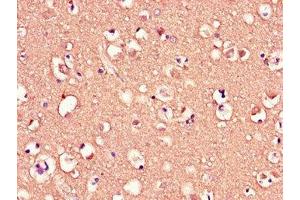 Immunohistochemistry of paraffin-embedded human brain tissue using ABIN7159104 at dilution of 1:100 (MED12 antibody  (AA 1742-2011))