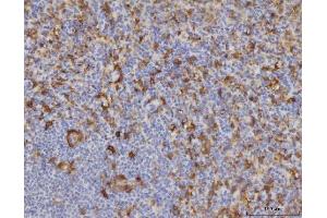 IHC analysis of ME1 using anti-ME1 antibody (ABIN7599485). (ME1 antibody  (AA 1-572))