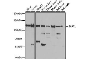 Western blot analysis of extracts of various cell lines, using SART1 antibody. (SART1 antibody)