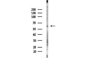 anti-Cyclin-Dependent Kinase 17 (CDK17) (Internal Region) antibody